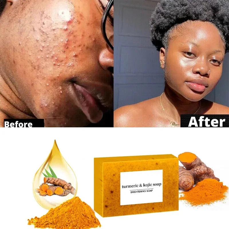 Turmeric Soaps Glow-skin Brightening  Exfoliates Skin Soap Multi-purpose Facial Care Supplies For Acne Body Skin Care