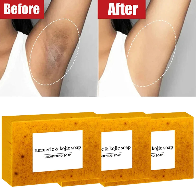 Turmeric Soaps Glow-skin Brightening  Exfoliates Skin Soap Multi-purpose Facial Care Supplies For Acne Body Skin Care