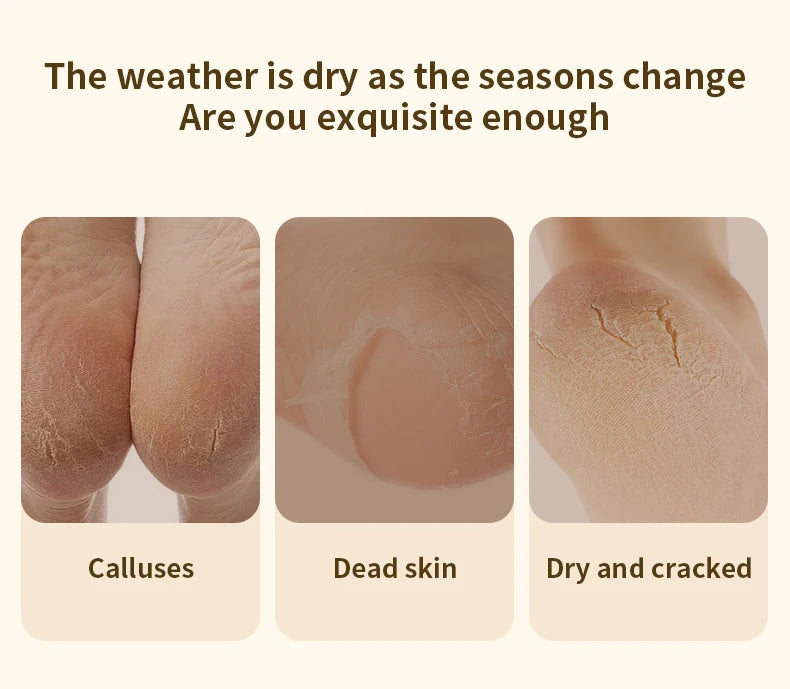 Amoladora de pies eléctrica automática, frotamiento de callos de pies, pedicura, eliminador de callos de piel muerta para máquina de belleza de pies