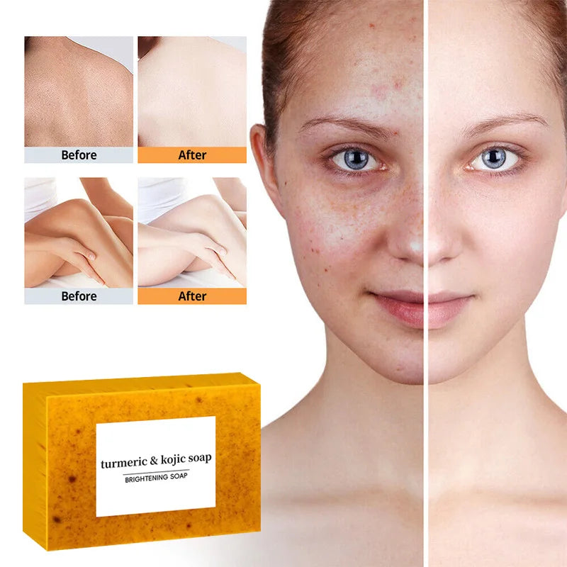 Turmeric Soaps Glow-skin Brightening  Exfoliates Skin Soap Multi-purpose Facial Care Supplies For Acne Body Skin Care